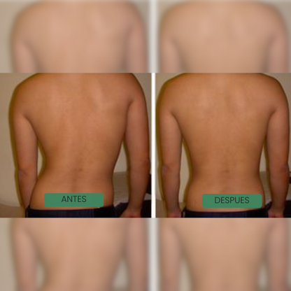 Corrector de Postura al instante